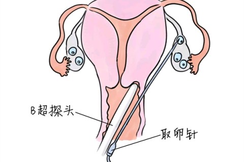 http://xiamen.vdtfzz.com/post/205.html|厦门供卵助孕