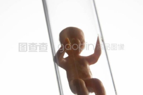 http://xiamen.vdtfzz.com/post/197.html|厦门试管助孕